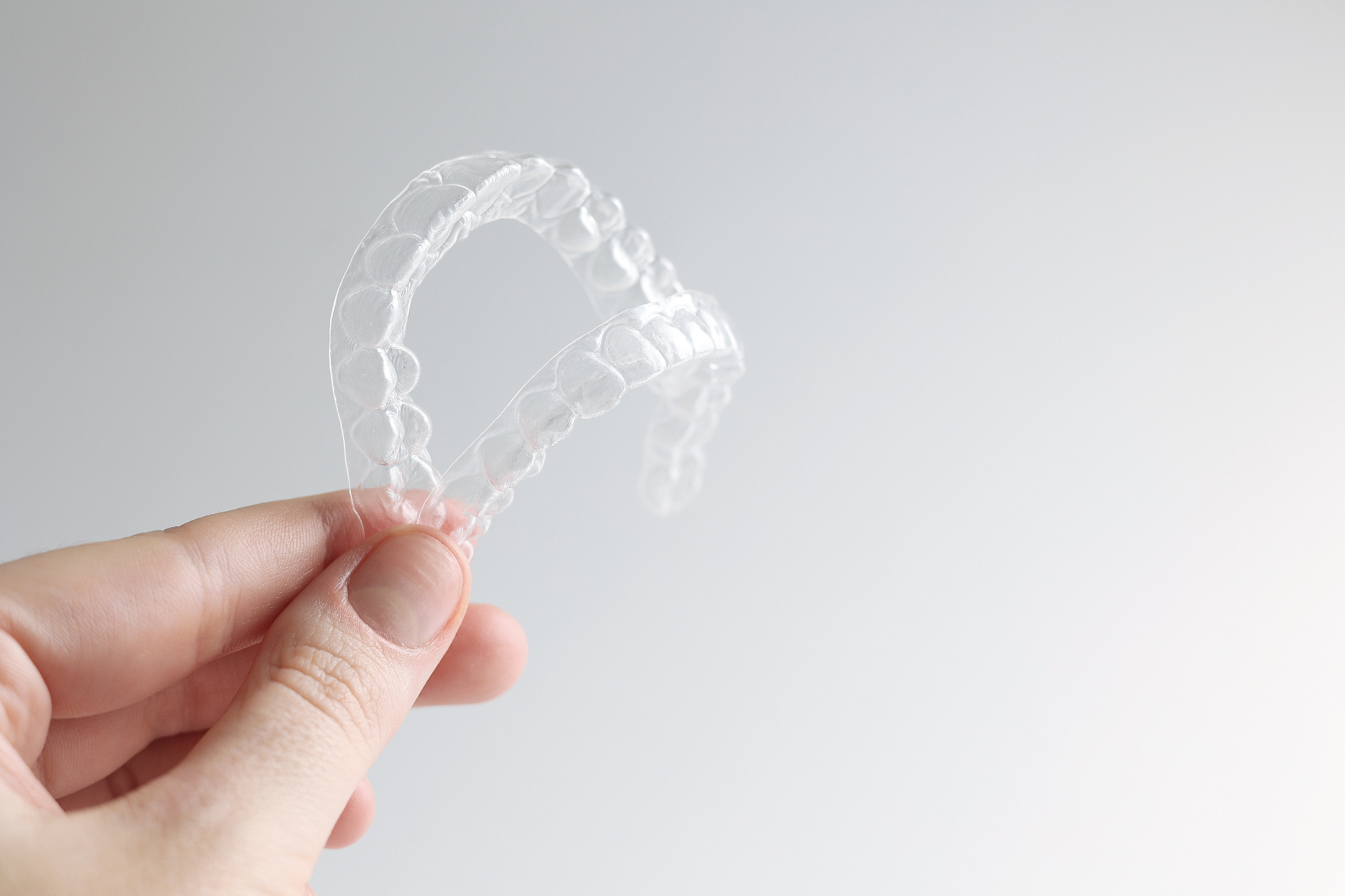 Vprašala sem kolikšna bi Invisalign cena lahko bila v mojem primeru